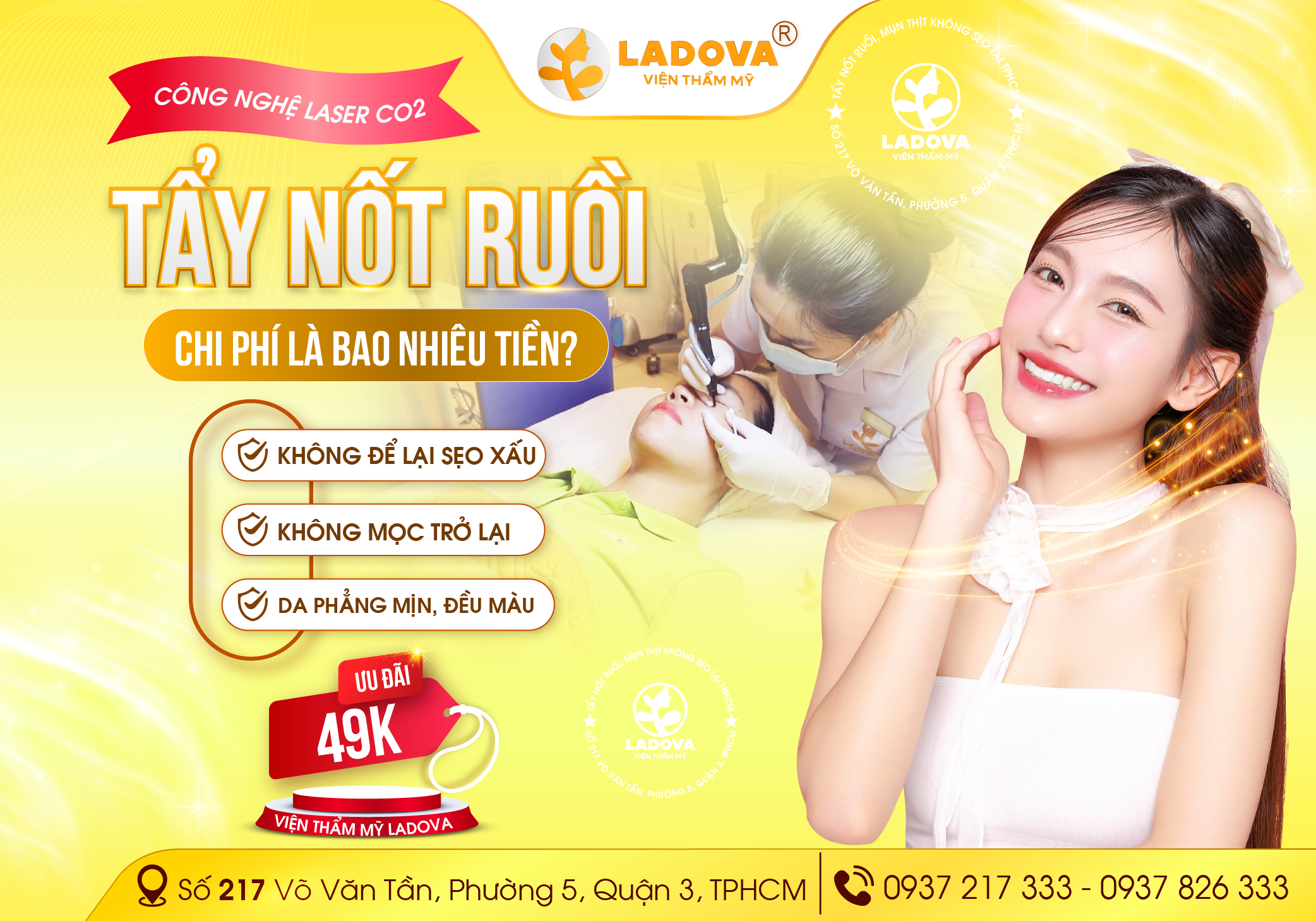 TAY-NOT-RUOI-BAO-NHIEU-TIEN-VTM-LADOVA-01