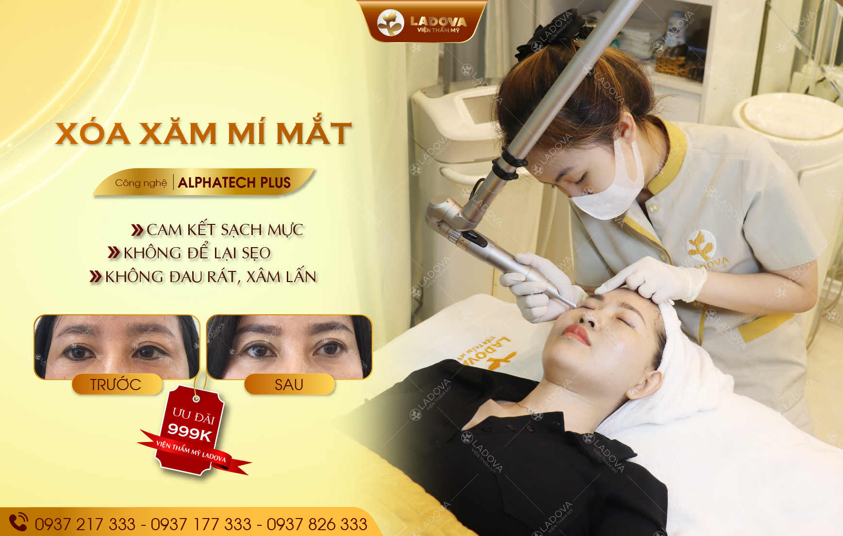 XOA-XAM-MI-MAT-SACH-MUC-01