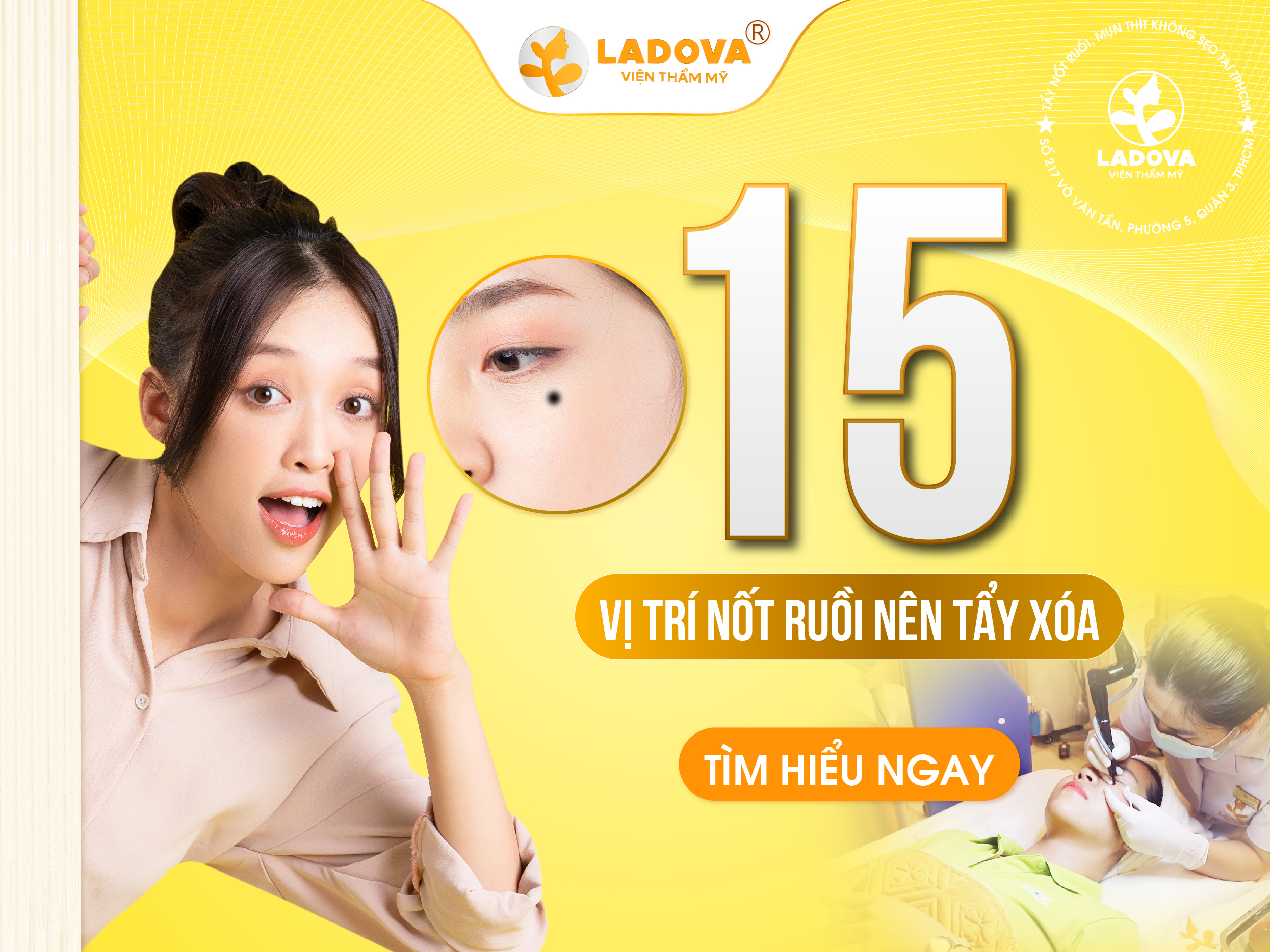 15-vi-tri-not-ruoi-nen-tay-xoa-01