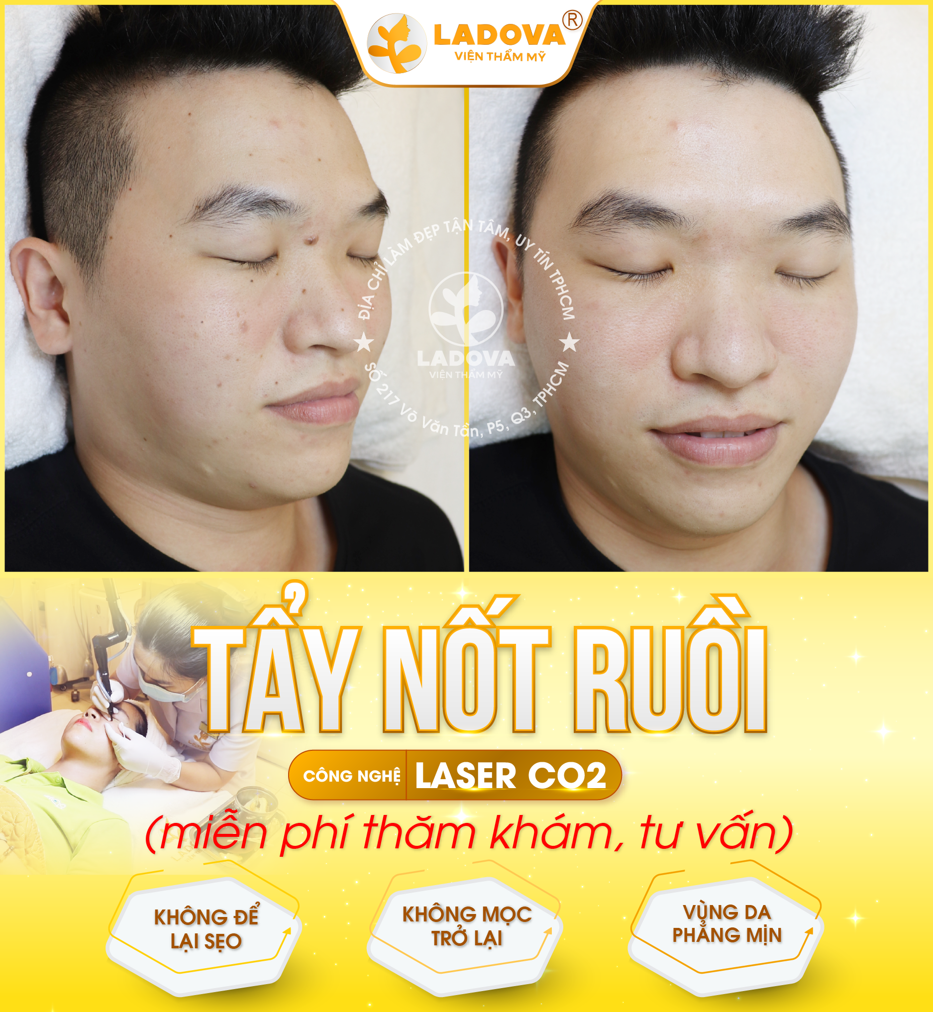 dia-chi-tay-not-ruoi-01