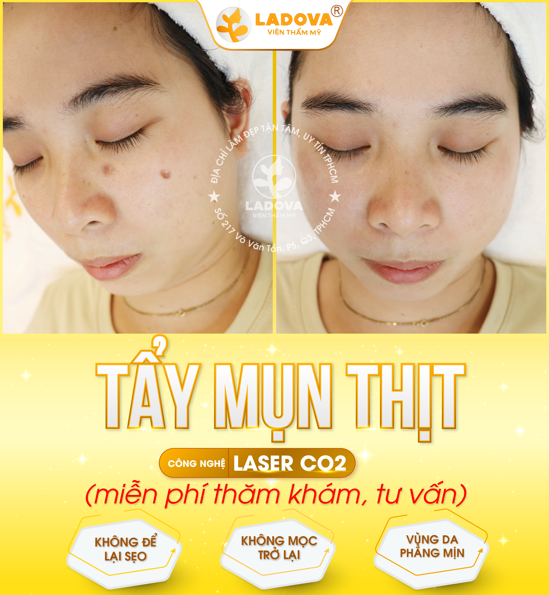 tay-mun-thit-01