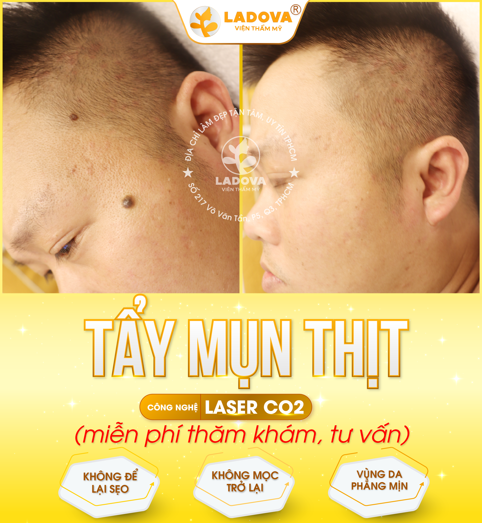 tay-mun-thit-khong-seo-01