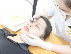 tay-not-ruoi-bang-laser-co2
