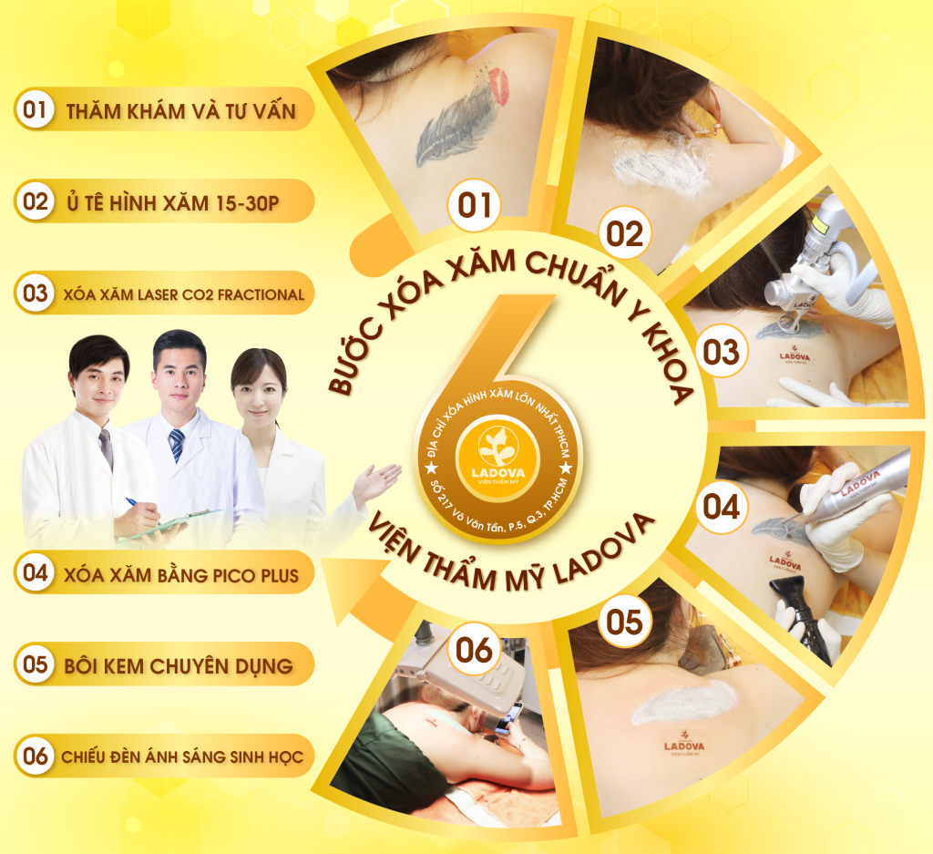 6-BUOC-XOA-HINH-XAM-01